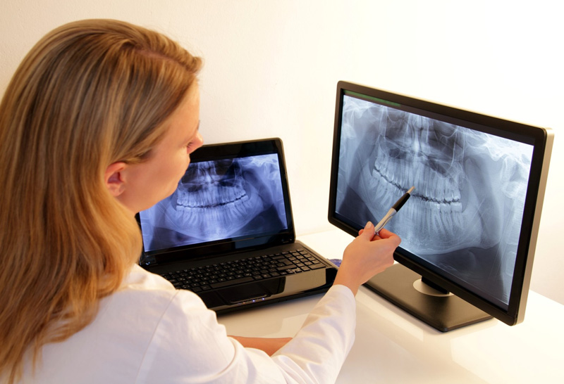 dental x-rays in winnipeg